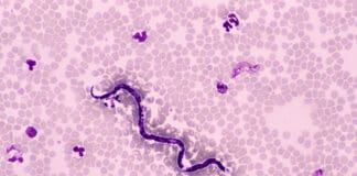 Dog hearworm medicine side effects are a possibility.