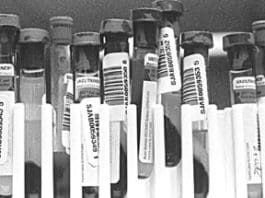 How to Best Utilize Your Dog’s Next Blood Test