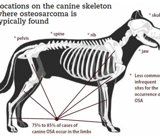 Osteosarcoma: Causes, Diagnosis, and Treatment
