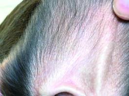 Cleaning dogs ears can help prevent ear infections later on down the line.