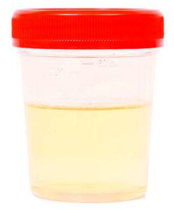 urinalysis for diagnosing pu pd in dogs